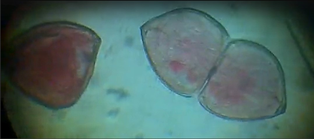 Glochidium