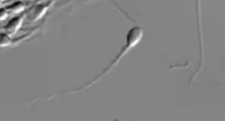 Sperm