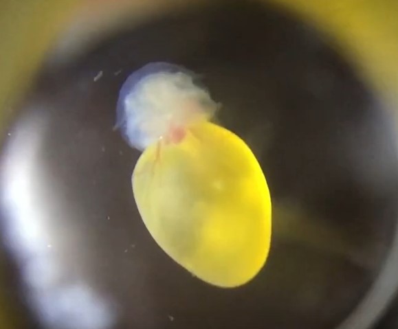 Yolk sac